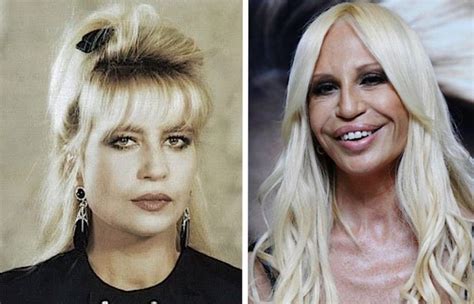 donatella versace e la sua imitazione|donatella versace before and after surgery.